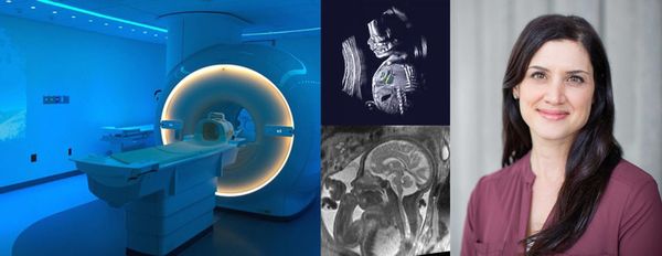 Montage with MRI machine, brain imaging and portrait of Shabnam Peyvandi, MD MAS