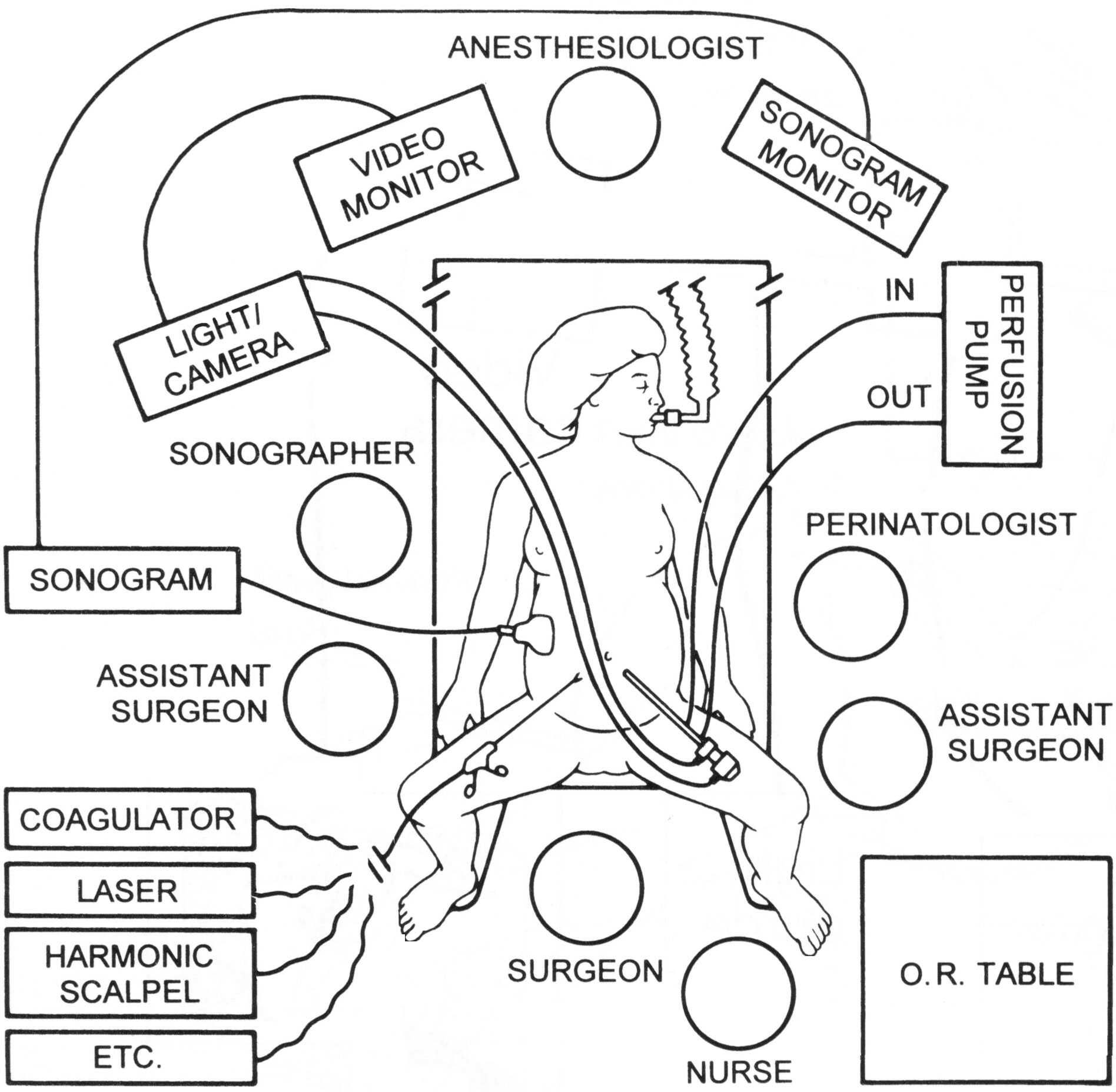 Fetendo Fetal Surgery OR