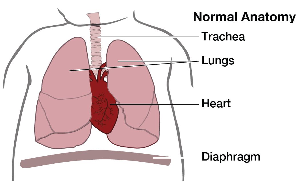 Illustration of normal lung anatomy