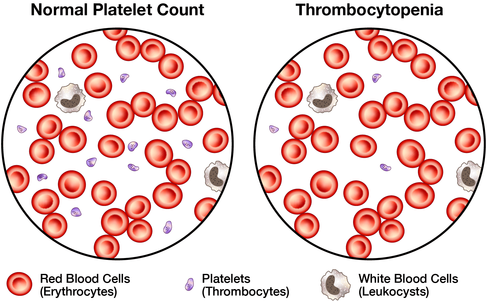 Fetal Anemia & Thrombocytopenia