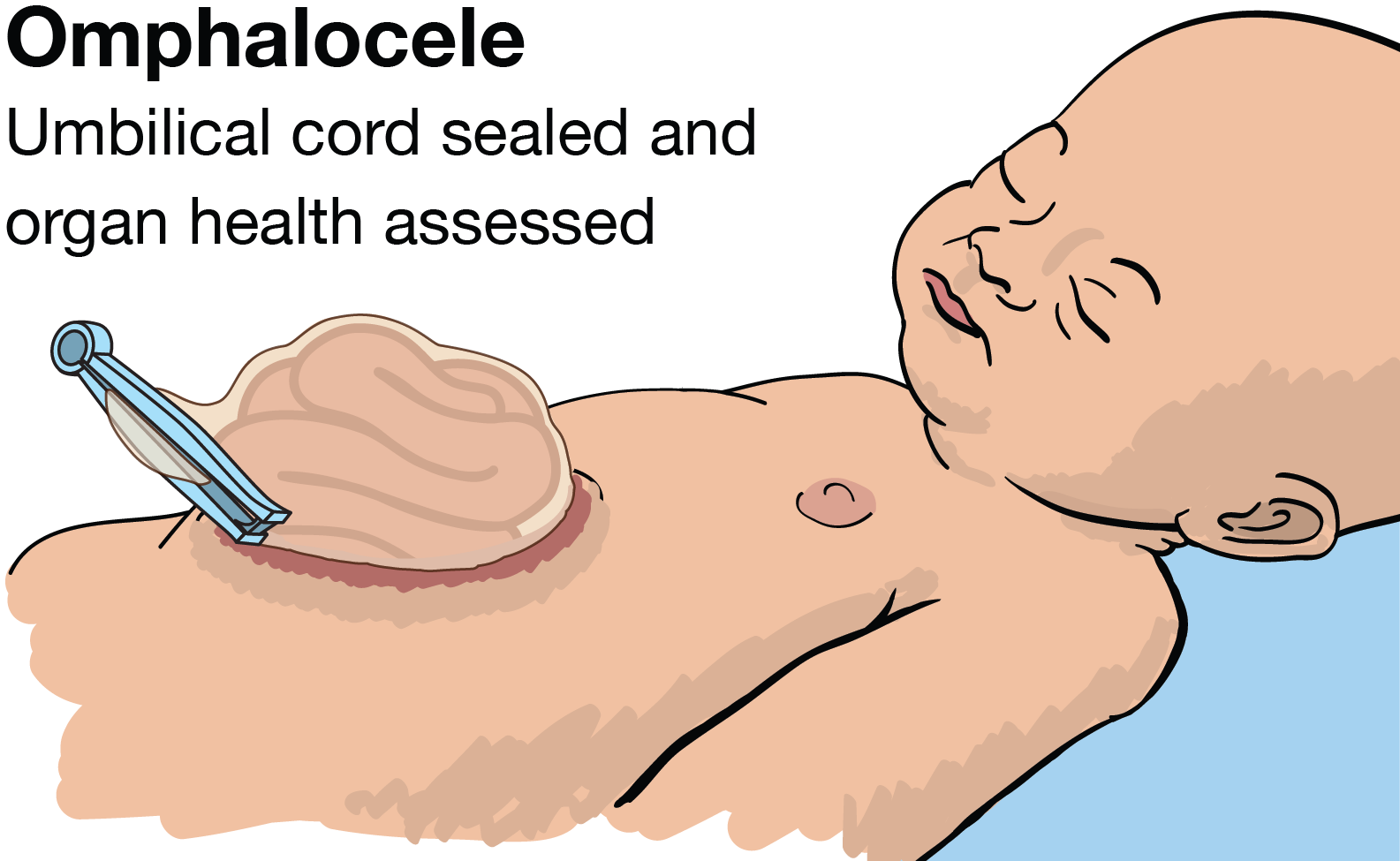 brachial pulse infant